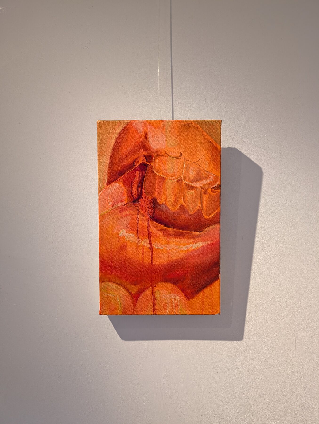 Exhibition — 14